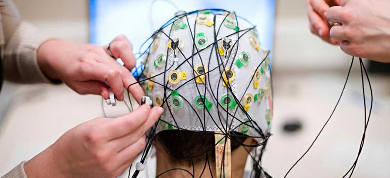 تخطيط الدماغ (EEG) وأنواع التصوير الطبي المتخصص مثل التصوير بالموجات فوق الصوتية (Ultrasound)، MRI، وCT Scan هي طرق تُستخدم لفحص تدفق الدم في الدماغ وتشخيص السكتة الدماغية