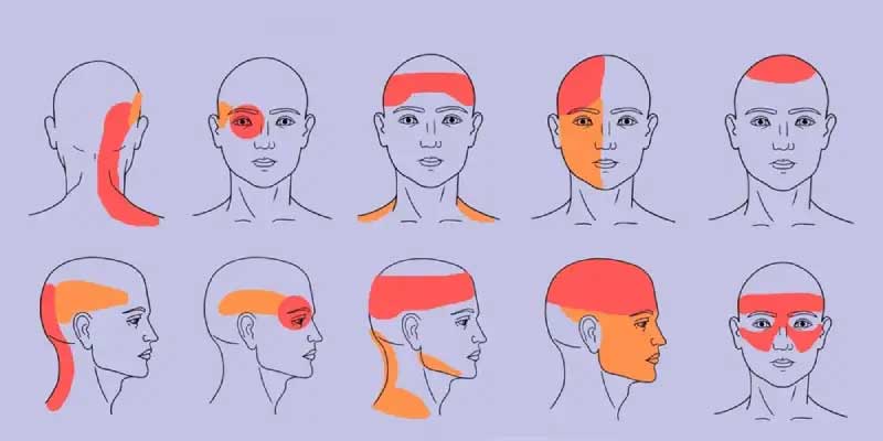 تُظهر الصورة أنواعاً مختلفة من الصداع